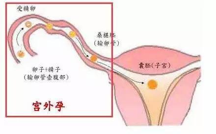 赠卵试管婴儿多少钱赠卵试管婴儿要多久才能成功