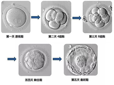 供卵试管移植单胎和双胎的成功率