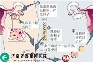 准备借卵做试管机构需要多长时间？