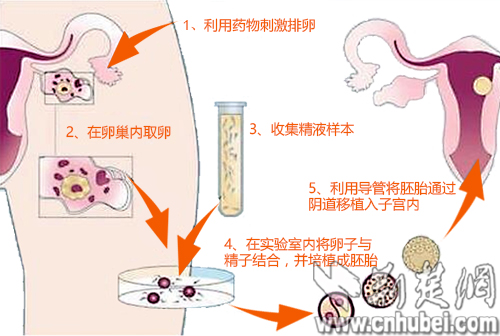 佛山哪家医院做供卵试管生子可以选择性别？求子家庭的集合