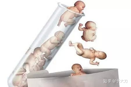 造人日记关于宫外孕你需要知道的事情