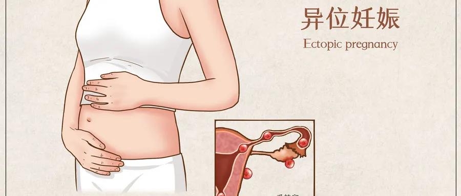 立生素对供卵试管移植的作用是什么