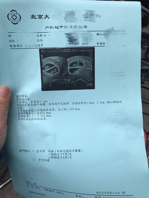 第二代做供卵试管婴儿和第三代做供卵试管婴儿的区别