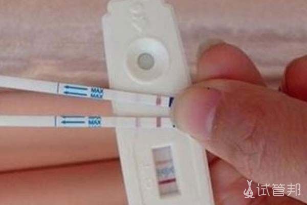 上海借卵做试管可以选择